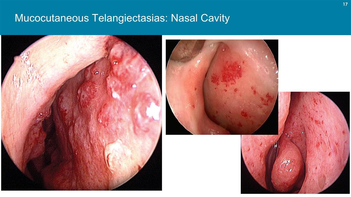 Slide 17