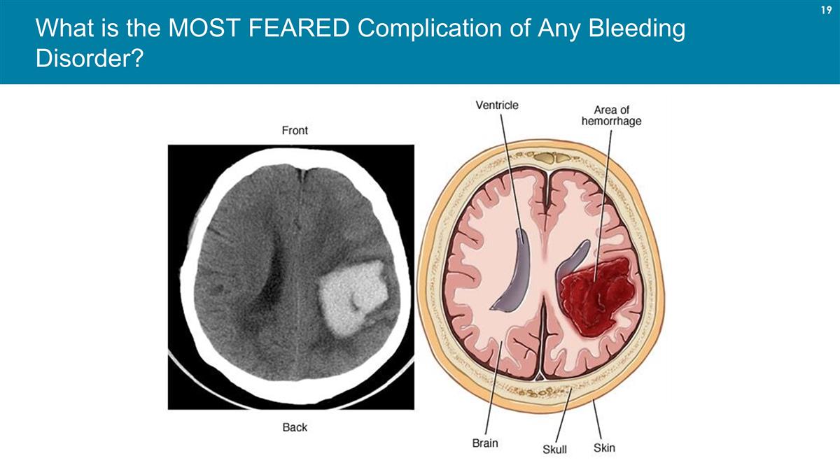 Slide 19