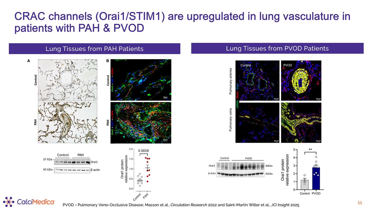 Slide 11