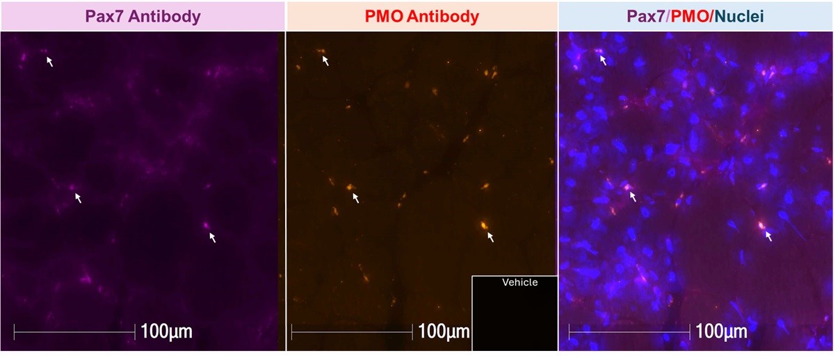 https://cdn.kscope.io/3a398602d01faeae42adf0d22f8dadbb-Satellite Cells.jpg