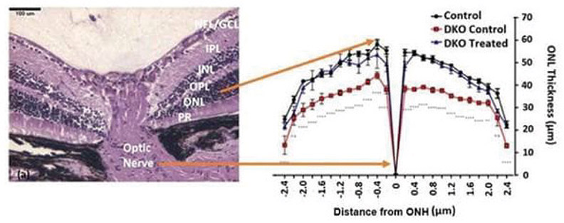[MISSING IMAGE: ph_distancefromonh-4clr.jpg]