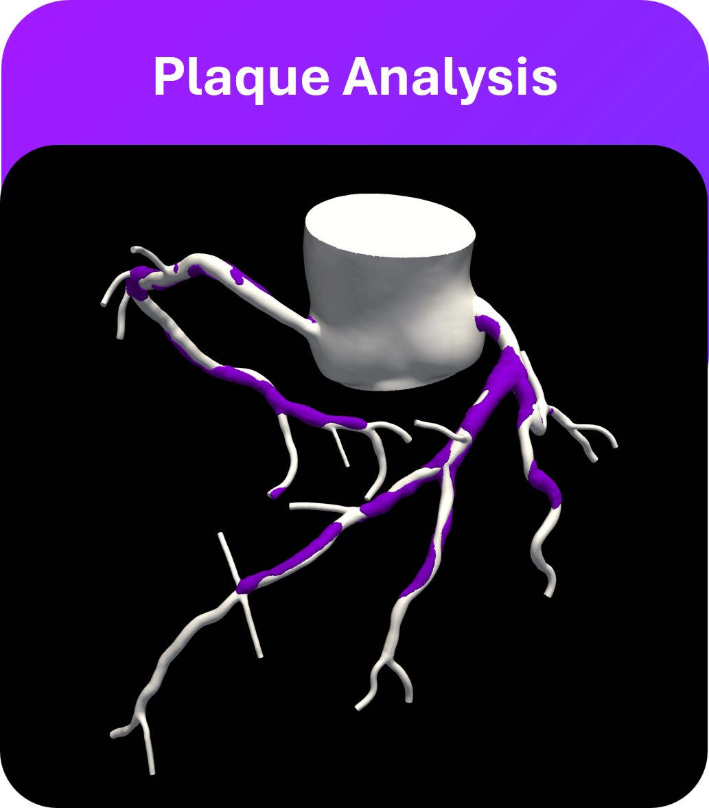 https://cdn.kscope.io/75d9ed0bfc8a2a59c45e3a7fd41cea2a-plaqueanalysis.jpg
