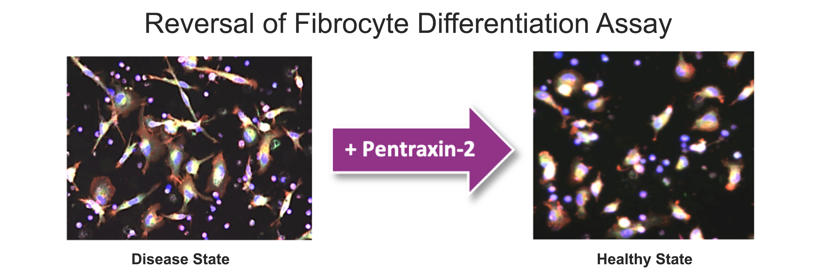 https://cdn.kscope.io/a5a1dcef7d06e7430dbe6f9452d96428-60_disease_state.jpg